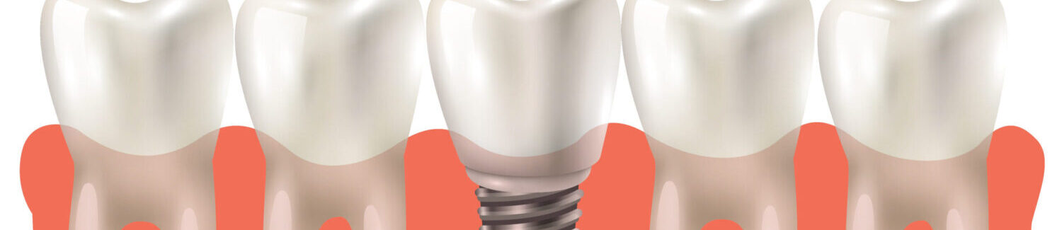 thubnail dental clinic sola image