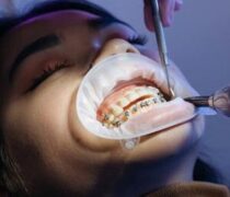 braces dental clinic near me care