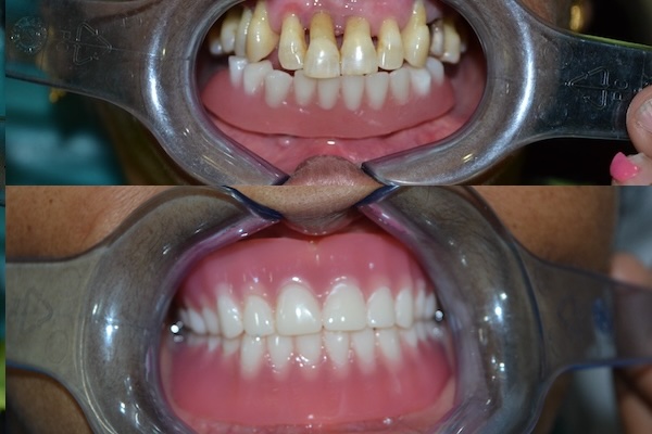 Rootcanal dental clinic near me sciencecity